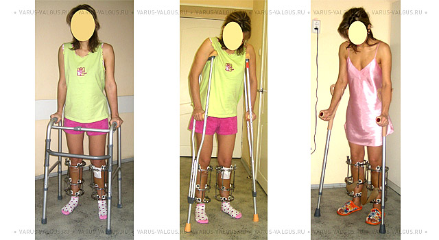 Modern support and mobility aids after surgery