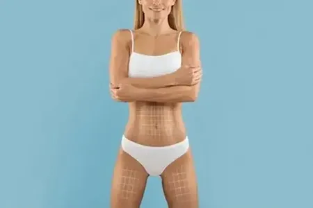 Slika sekcije